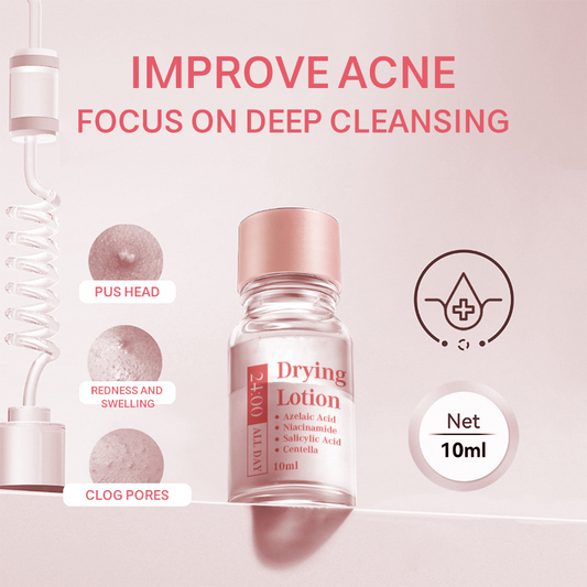 ✨ 50% KORTING – Salicylzuur Spot Drying Lotion! 🌟 Werking 's nachts, snelle vermindering van puistjes en huidherstel 💆‍♀️💧Huidherstel 💆‍♀️💧