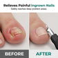🔥50% KORTING✂️ Pedicure set nagelverzorging professioneel